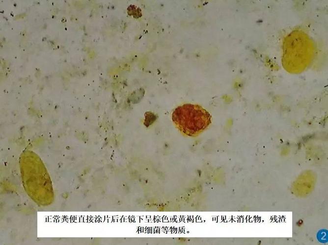 免费送!血细胞形态学诊断及图谱,尿液 寄生虫图谱,粪便常规一起送!