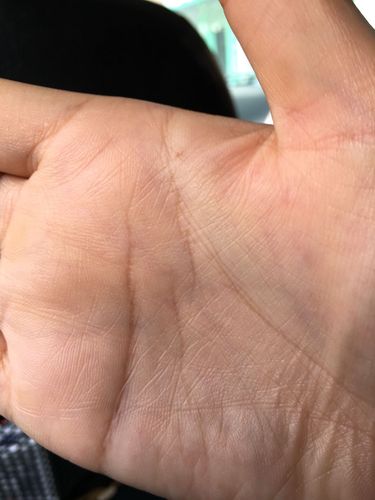 智慧线从中间断开什么意思