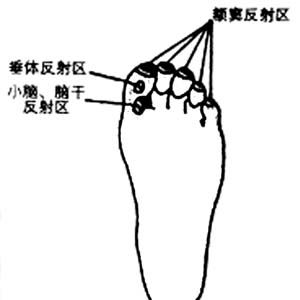 老年痴呆线脚底图解