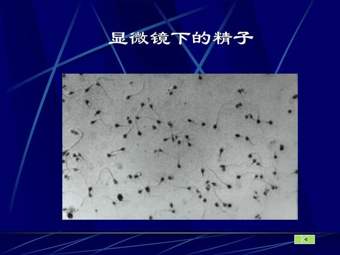 显微镜下的精子