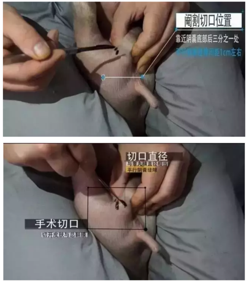 平行阴囊缝隙1cm左右划开皮肤与总鞘膜,切口直径要与睾丸横径相当