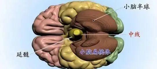 小脑萎缩为何会出现下肢无力