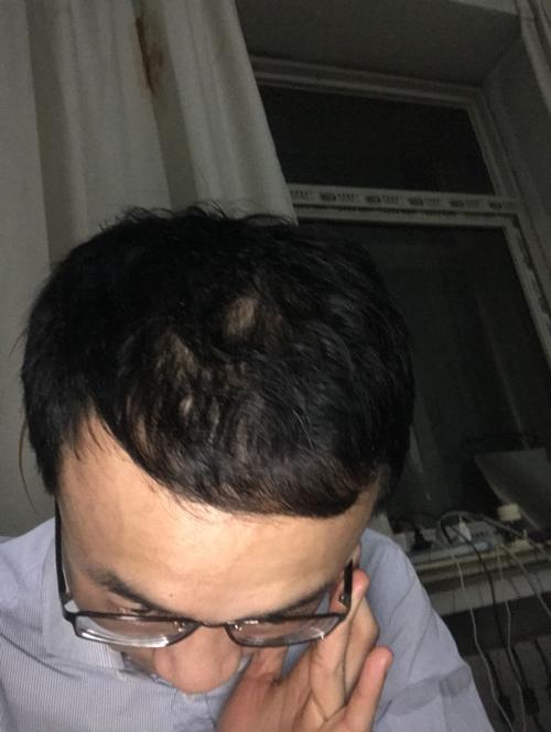 之前的话,坏习惯sy,导致肾虚!