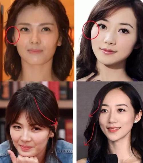 除了面部填充这个途径之外,还可以用额发或刘海来修饰过突出的颧骨