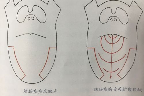 舌诊九区定位法