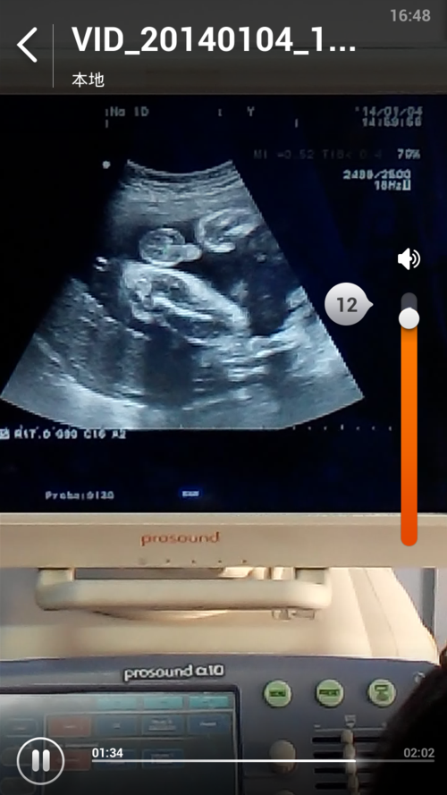 怀孕30周零2天,b超检查,这是男孩还是女孩?