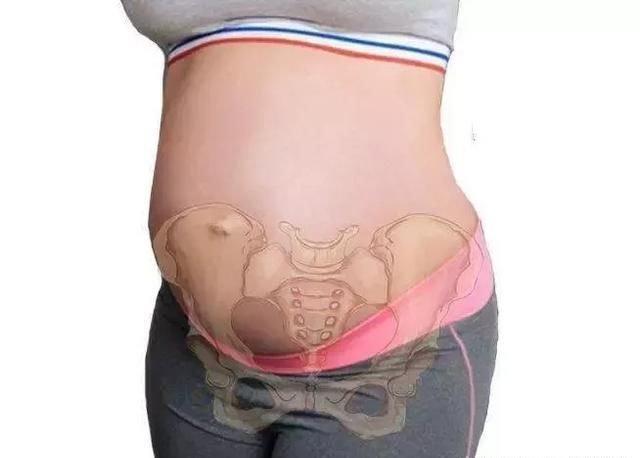 耻骨联合疼痛就靠忍?聪明的孕妇善用6个方法,舒适度过孕期