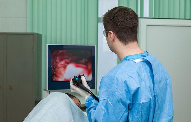 只要是空腔器官,就可以借助内镜检查!一文告诉你都有哪些内镜