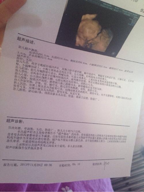 生男孩最准的症状怀孕四月了,怀男孩会有哪些反应,胎动早的会是男孩吗