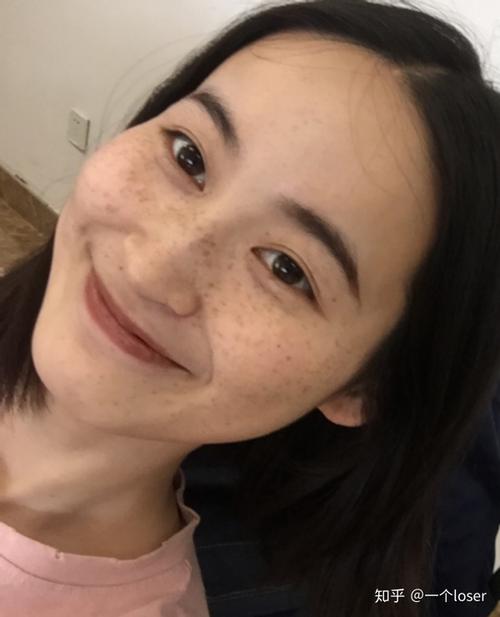 不得不说长雀斑确实会给女生带来困扰 我觉得虽然雀斑给我带来了困扰