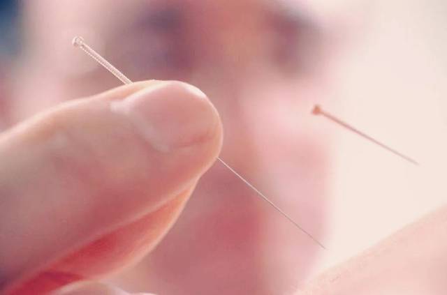 乳腺增生可否用针灸治疗?国医大师帮您解答!