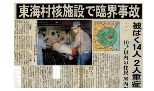 他是死法最惨的日本人:近距离遭受核辐射,医生强行为他续命83天