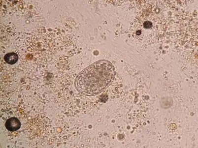 钩虫卵形态变化过程图