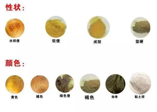 读懂宝宝便便,判断宝宝身体是否健康_大便