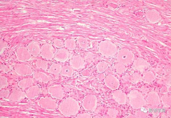 脊神经节细胞的周围突,随同交感神经和骶部副交感神经分布于内脏器官