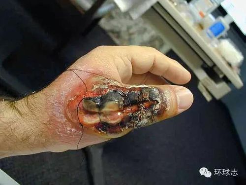 红背蜘蛛: 在较为潮湿的时节和1月份前后,白额高脚蛛可能会常常出没