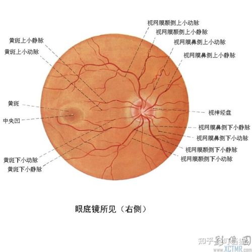 这里先给大家看一个正常人眼底的照片