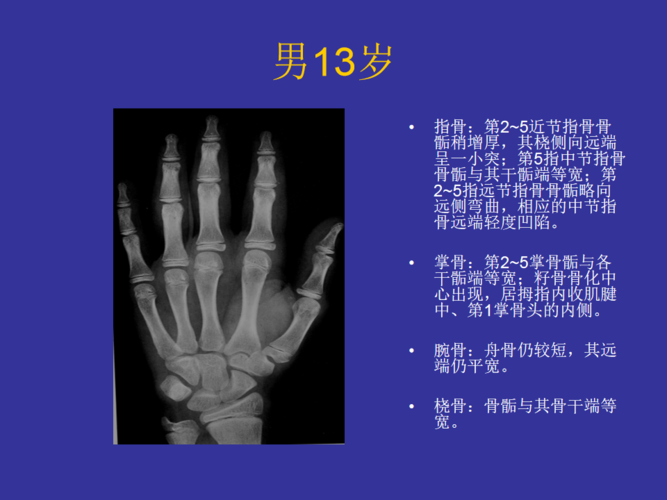 男性骨龄读片指南