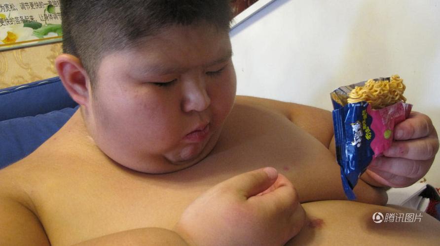 男孩体重286斤患"小胖威利综合征" 3岁体重86斤