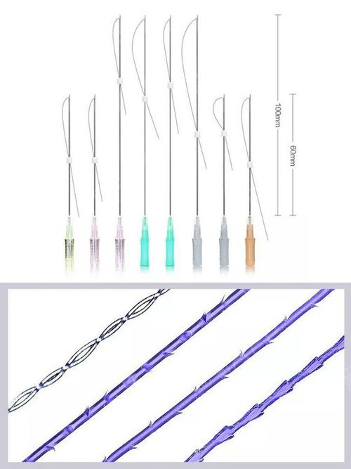 线雕提升真的能实现人的逆生长吗