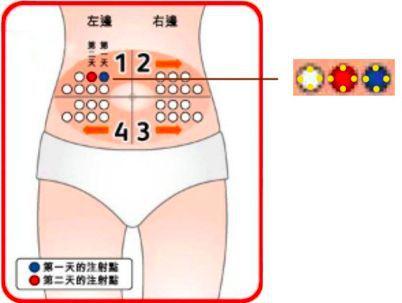 可能是你选错了注射部位!| 健识药师谈