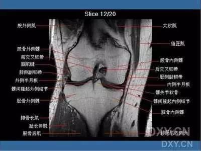 高清图解:磁共振下的膝关节