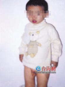 幼儿园2岁小孩尿床 遭园长粗暴将其生殖器拽红肿(图)