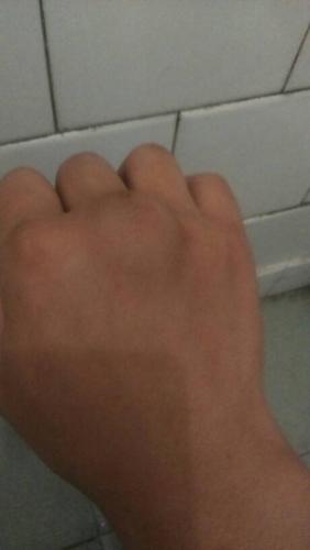 刚才跟女友吵架气的锤墙 手这怎么回事