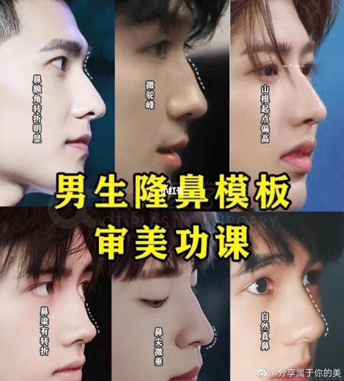 男生鼻子模版_整容_隆鼻_广州攻略_鼻综合_支架_美妆