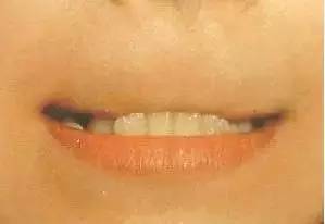 【儿童保健】张嘴睡觉会变丑?七个口腔坏习惯让孩子