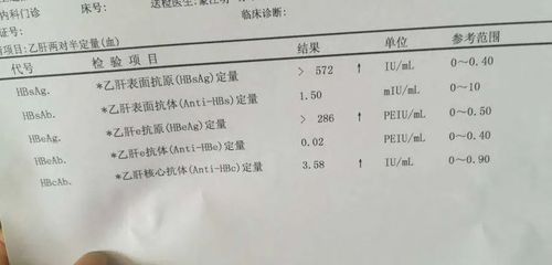 hbv dna称为乙肝病毒脱氧核糖核