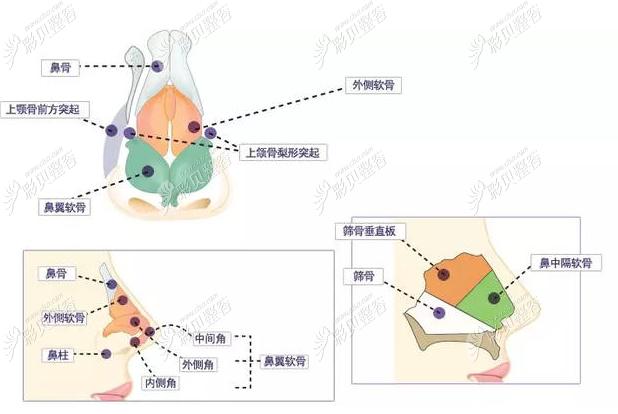 歪鼻矫正和鼻中隔偏曲矫正手术一样吗它们可以一起做吗