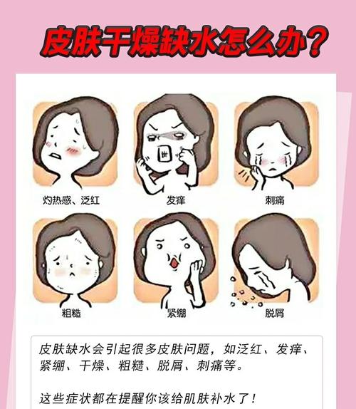 皮肤干燥缺水怎么办?