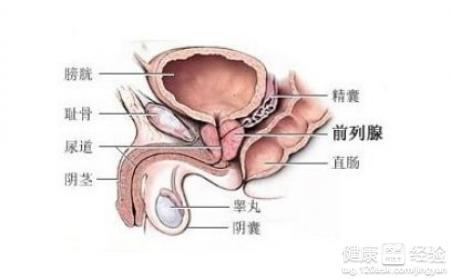 不知如何治疗前列腺增生