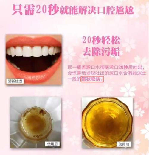 漱口水有哪些功效和副作用?