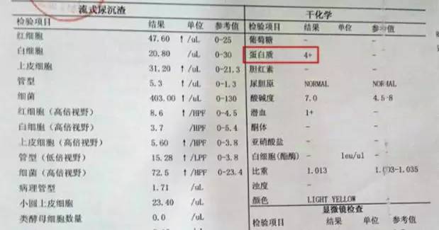 得了肾病,尿检只看尿蛋白?错!这五项指标都得看