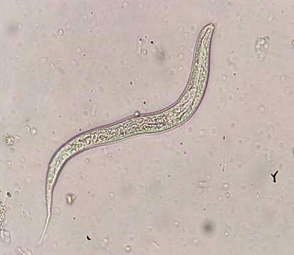 昨日"虫"现-在检验科养钩虫是一种什么样的体验?