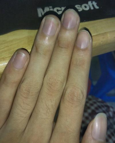 23岁手指甲暗紫怎么搞的,好害怕.平时也有运动什么的.