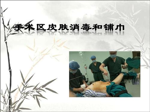 手术区皮肤的消毒和铺巾.ppt