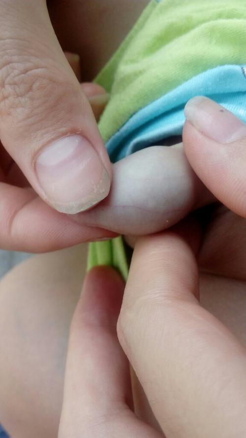 宝宝jj里面不知道长了什么白白的?