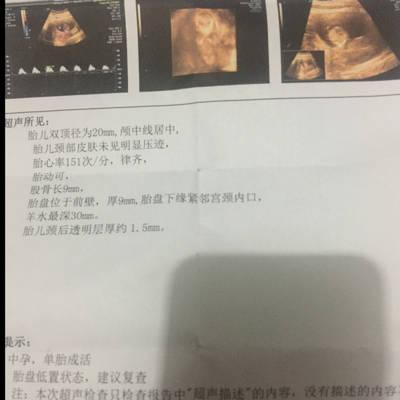 问答 怀孕期  宝宝树孕育 90%的妈妈正在使用 宝宝树孕育 90%的妈妈