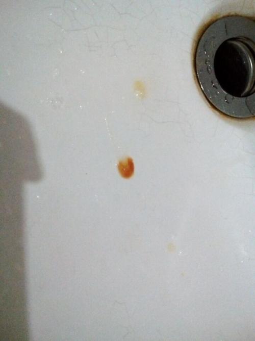 感冒后喉咙每次吐出来的痰都带有血,怎么回事?