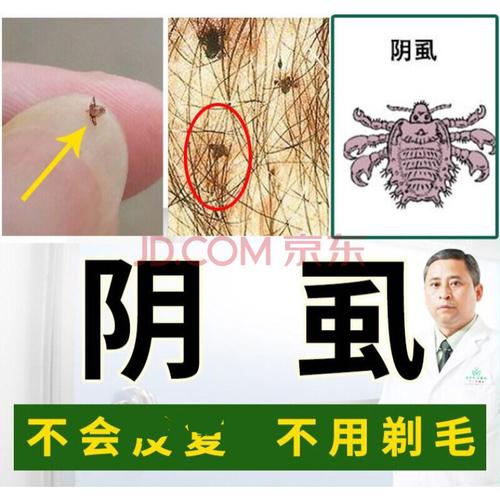 男女私处阴虱佳必虱无踪亮友虱立净通济堂得御泓康虱立洁克虱露百部酊