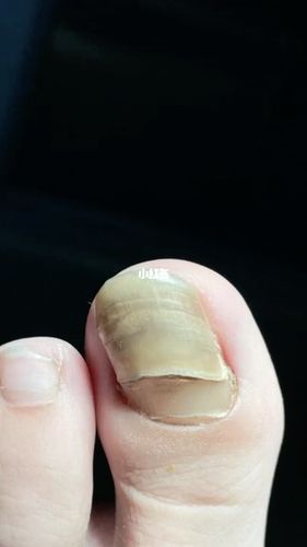 拔出复甲 全过程,非常过瘾!_指甲油_显白_最显白的油