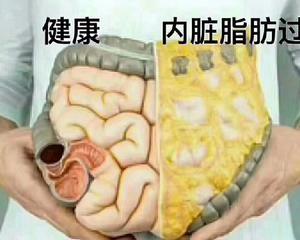 什么是内脏脂肪