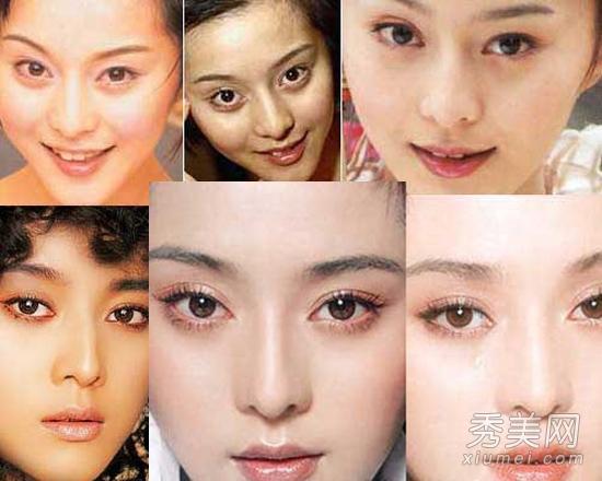 17位被整容明星变脸前后对比照