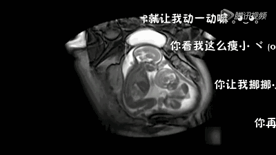 【宝宝胎动】胎动:看看宝宝们在肚子里怎样大闹天宫的,怀你家宝宝也