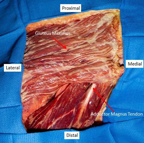 gluteus maximus and common hamstring muscle group with