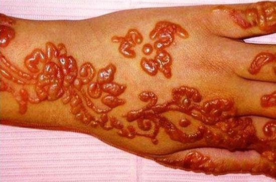 世界十大禁忌文身:割肉文身看着都疼|纹身|疤痕|刺青