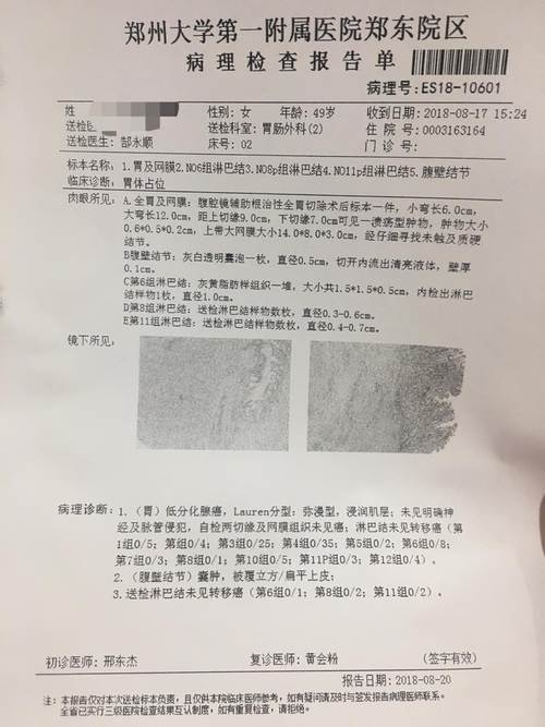 病理报告
